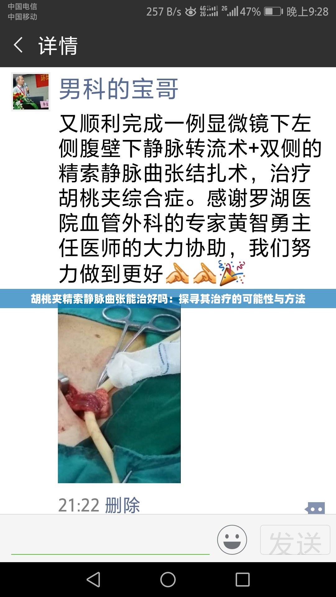 胡桃夹精索静脉曲张能治好吗：探寻其治疗的可能性与方法