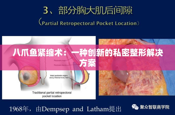 八爪鱼紧缩术：一种创新的私密整形解决方案