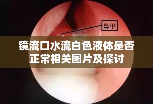 镜流口水流白色液体是否正常相关图片及探讨